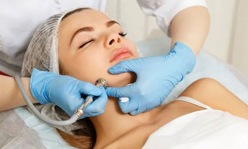 Dermabrasion Treatment in Nagpur