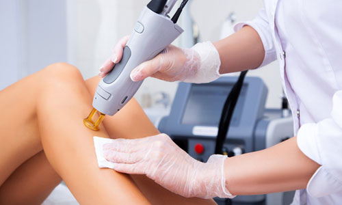 Laser Hair Removal