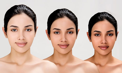 Skin Whitening Treatment