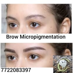 Brow Micropigmentation