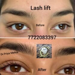 Lash Lift