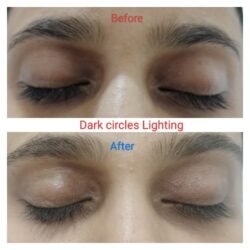 Dark Circle Lighting