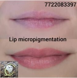 Lip Micropigmentation
