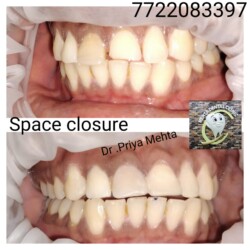 Space Closer Space Closer